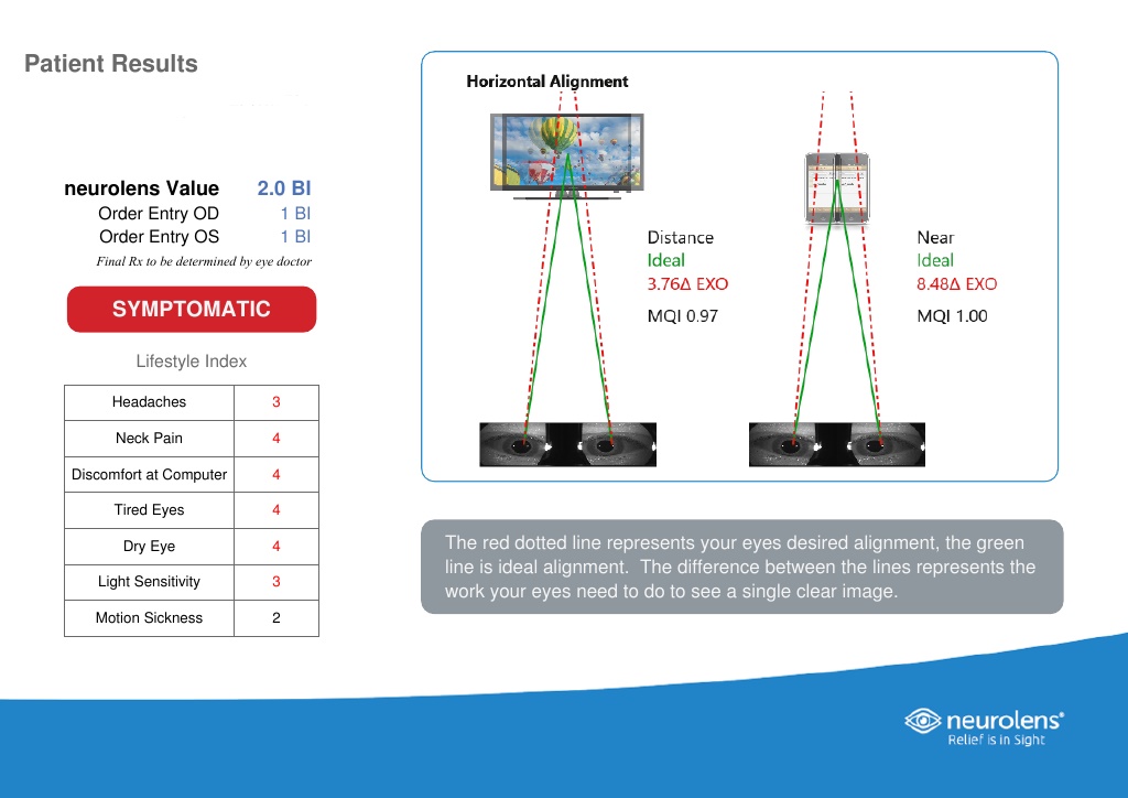 neurolens-results-example NEUROLENS